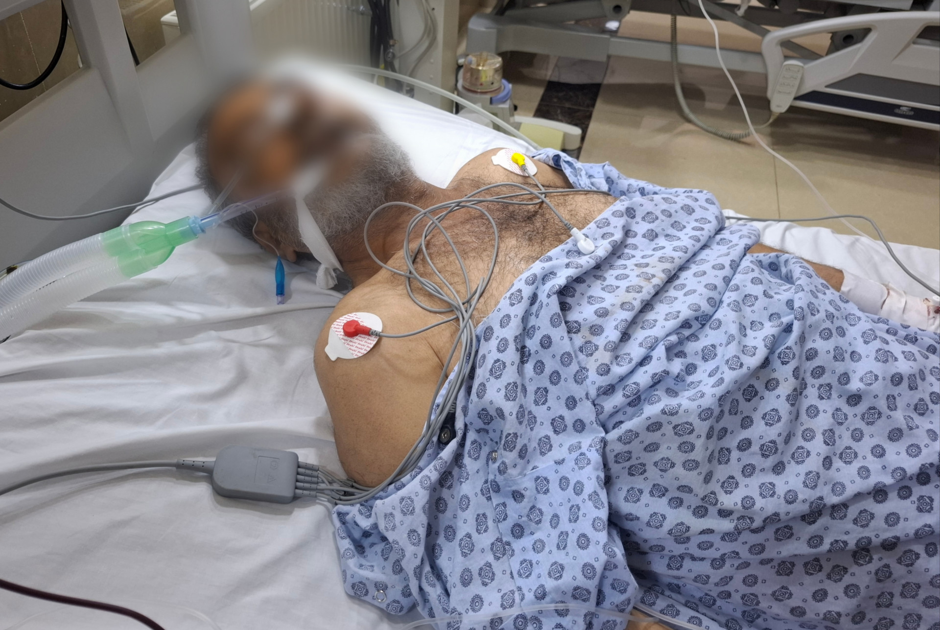 Mahmoud is fighting for his life!