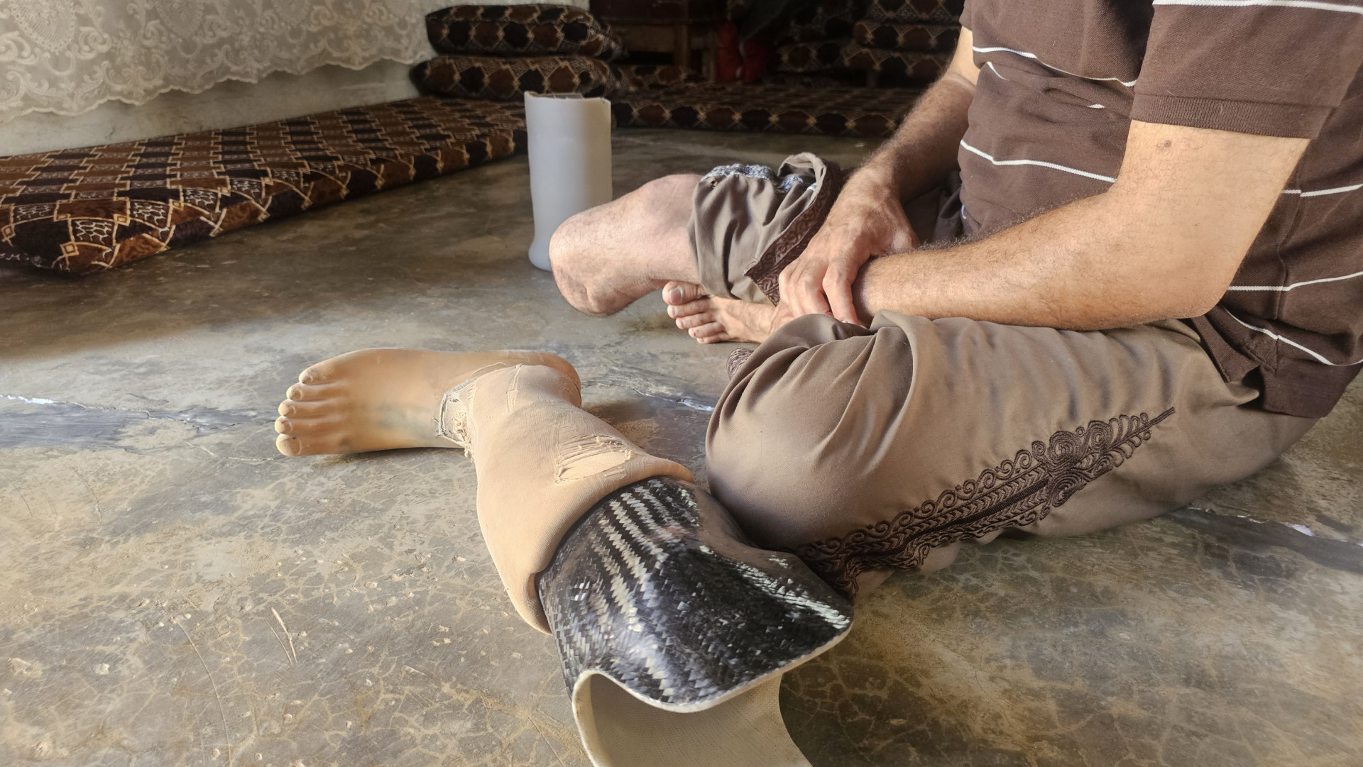 A Father Without a Leg, Unable to Work