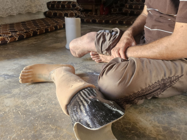 A Father Without a Leg, Unable to Work