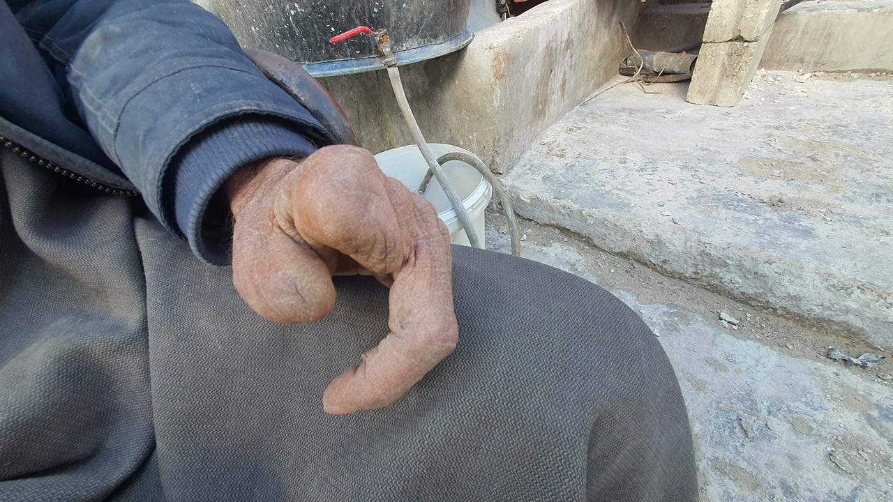 Ahmad is injured and needs your generous help