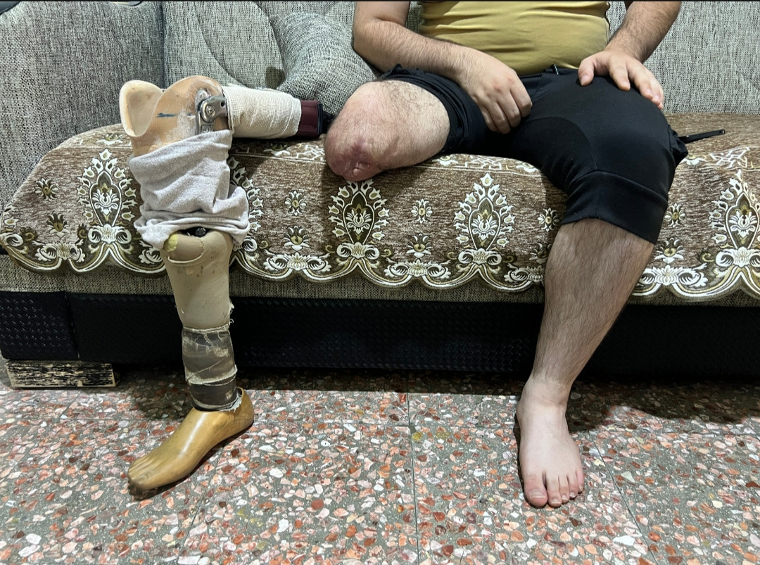 حسين… يحمل أثر الإصابة وهمّ عائلته