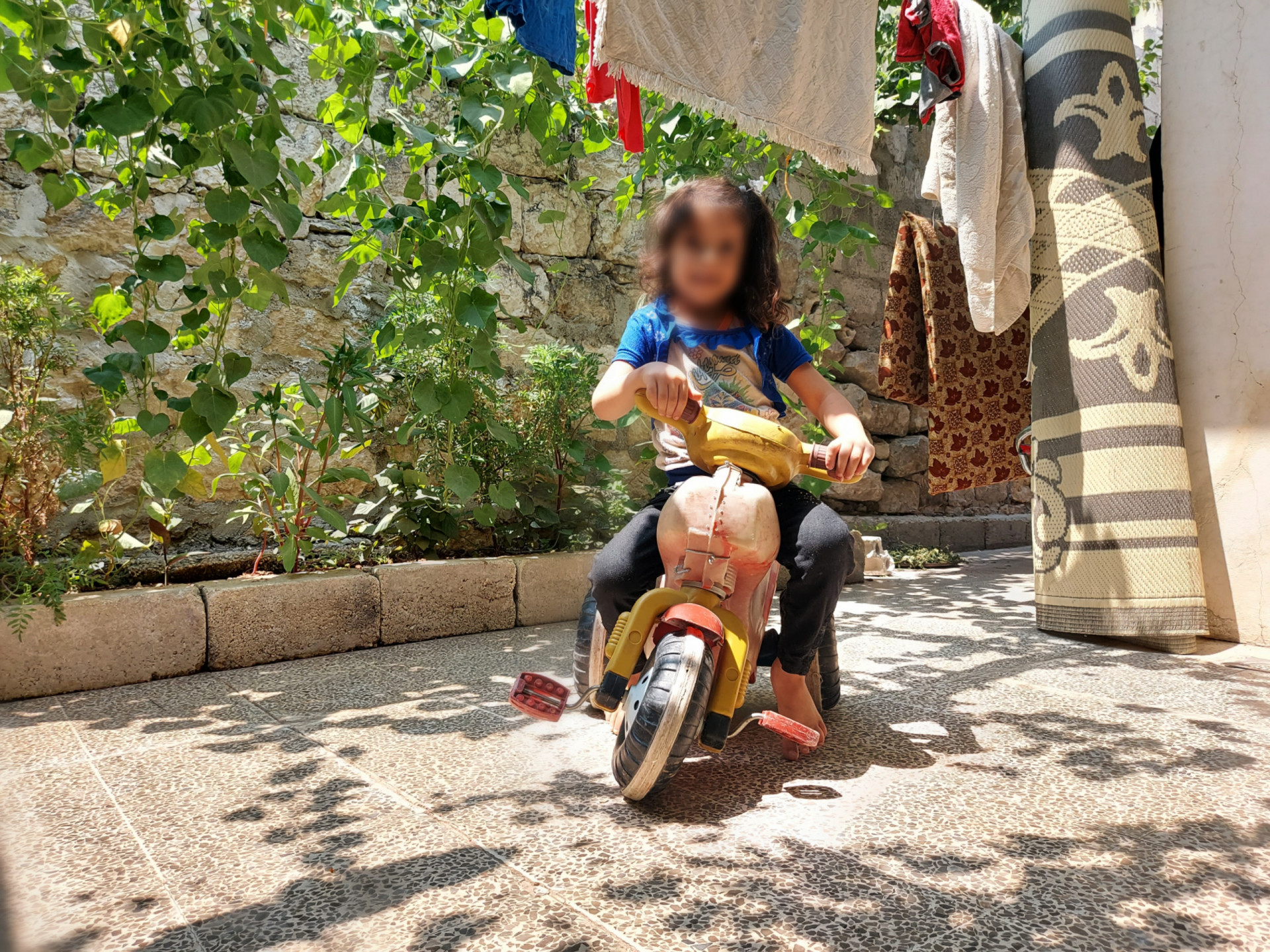 Child has a Congenital Deformation