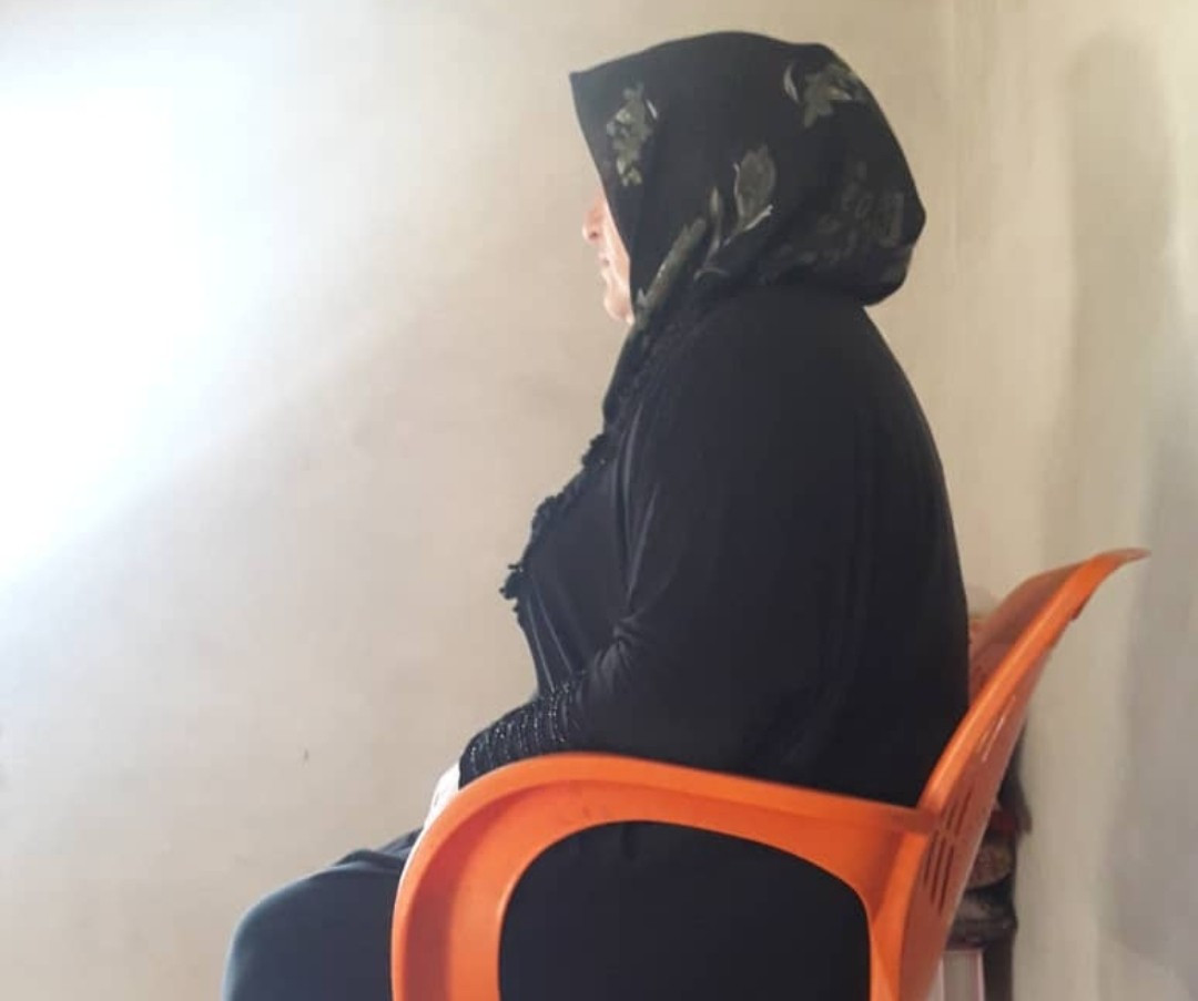 A woman with osteoarthritis ( joint inflammation)