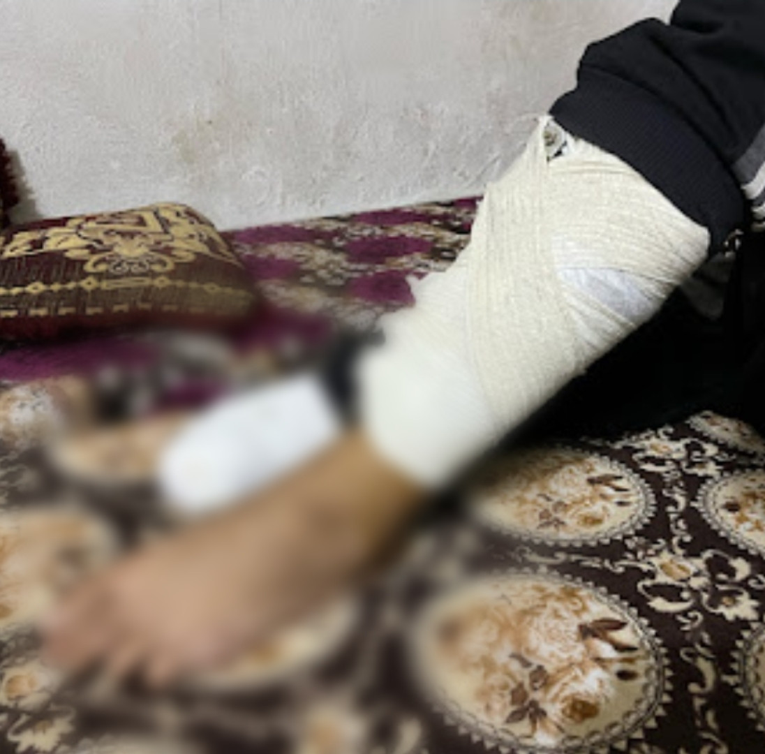 Mohammed... Landmine Victim in Search of a Dignified Life