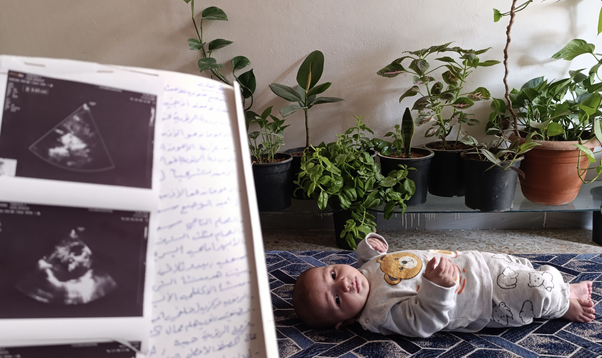 رضيعٌ يصارعُ فتحةً في القلب
