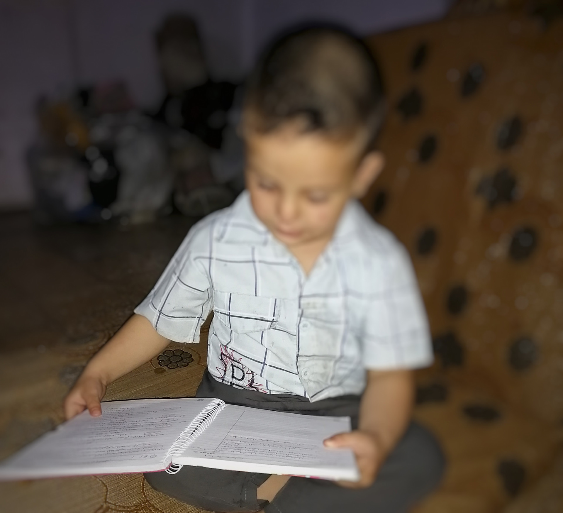 طفل يعاني من شك ارتخاء بعصب العين!