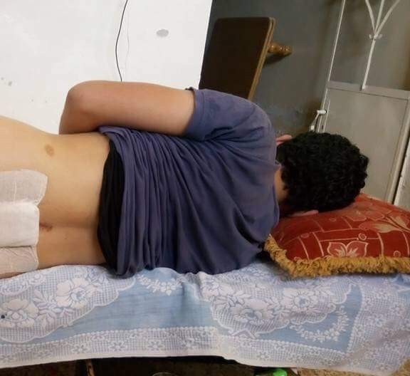 Young man needing surgery