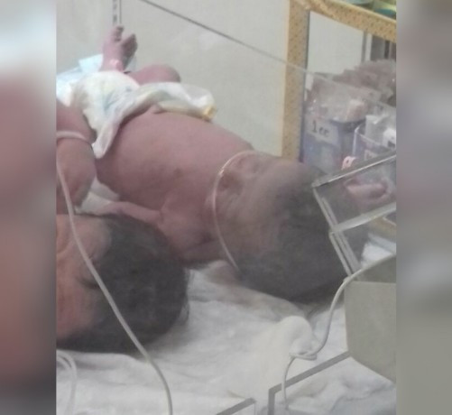 a baby in need of an incubation