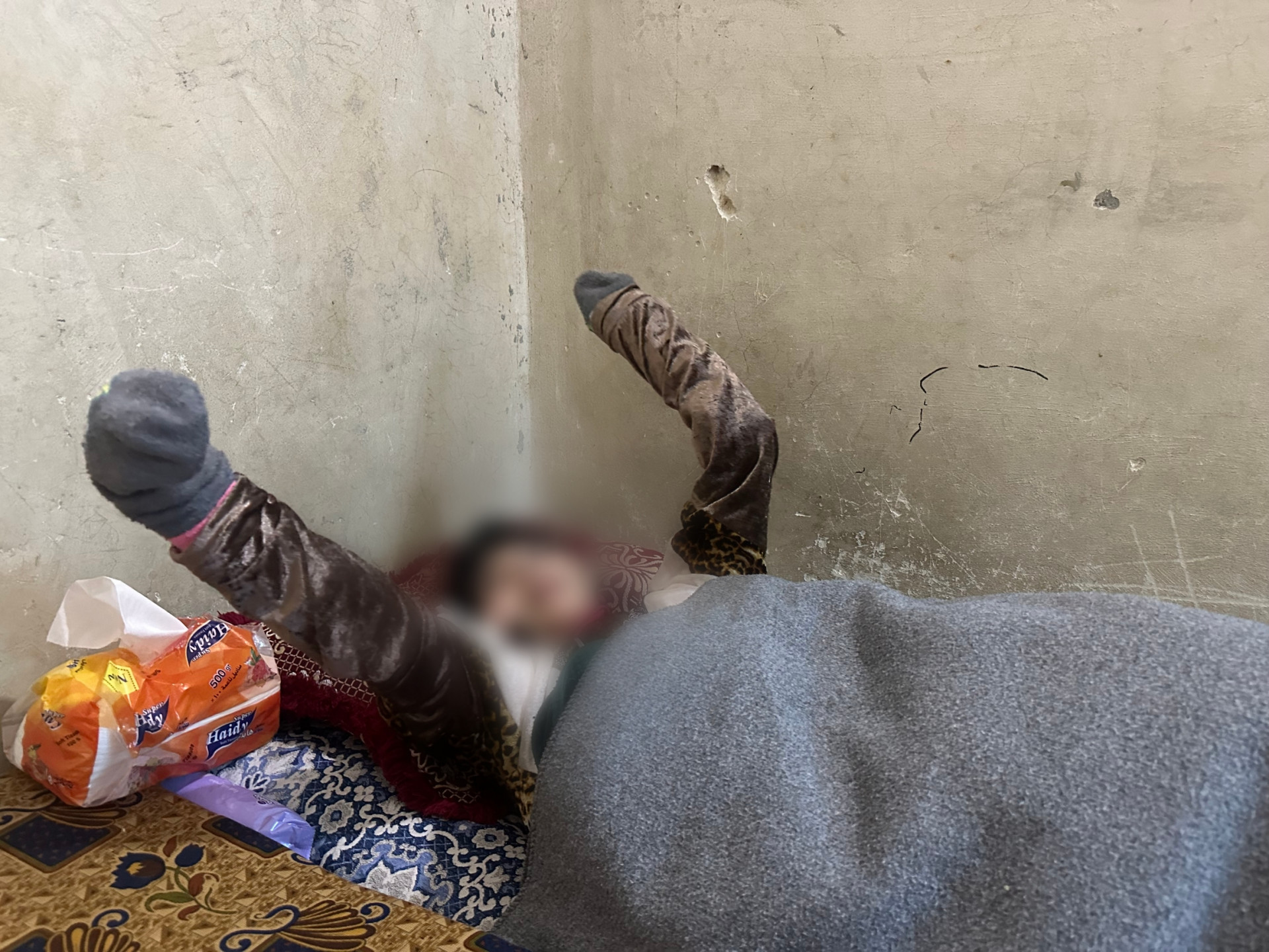 Cerebral atrophy devastated Doha's body.
