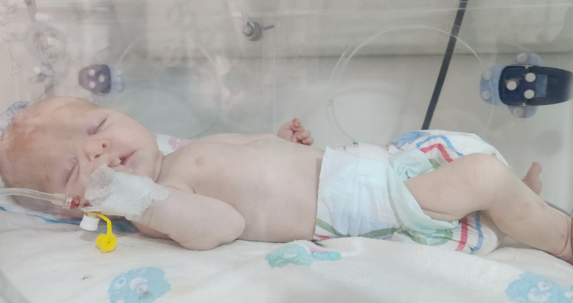 Oxygen deprivation and seizures at birth left him fighting for his life