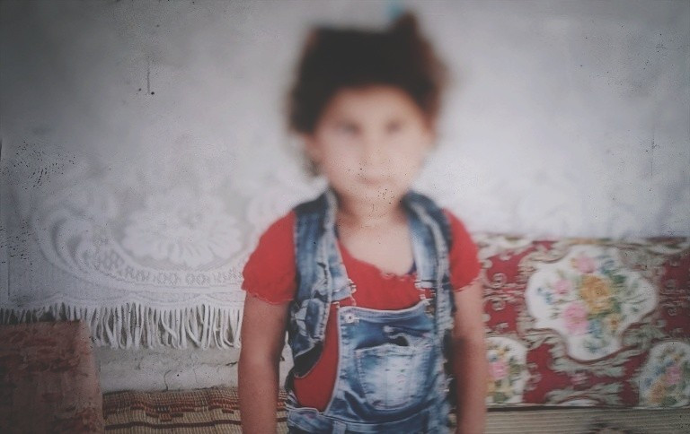 A little girl suffers from Astigmatism!
