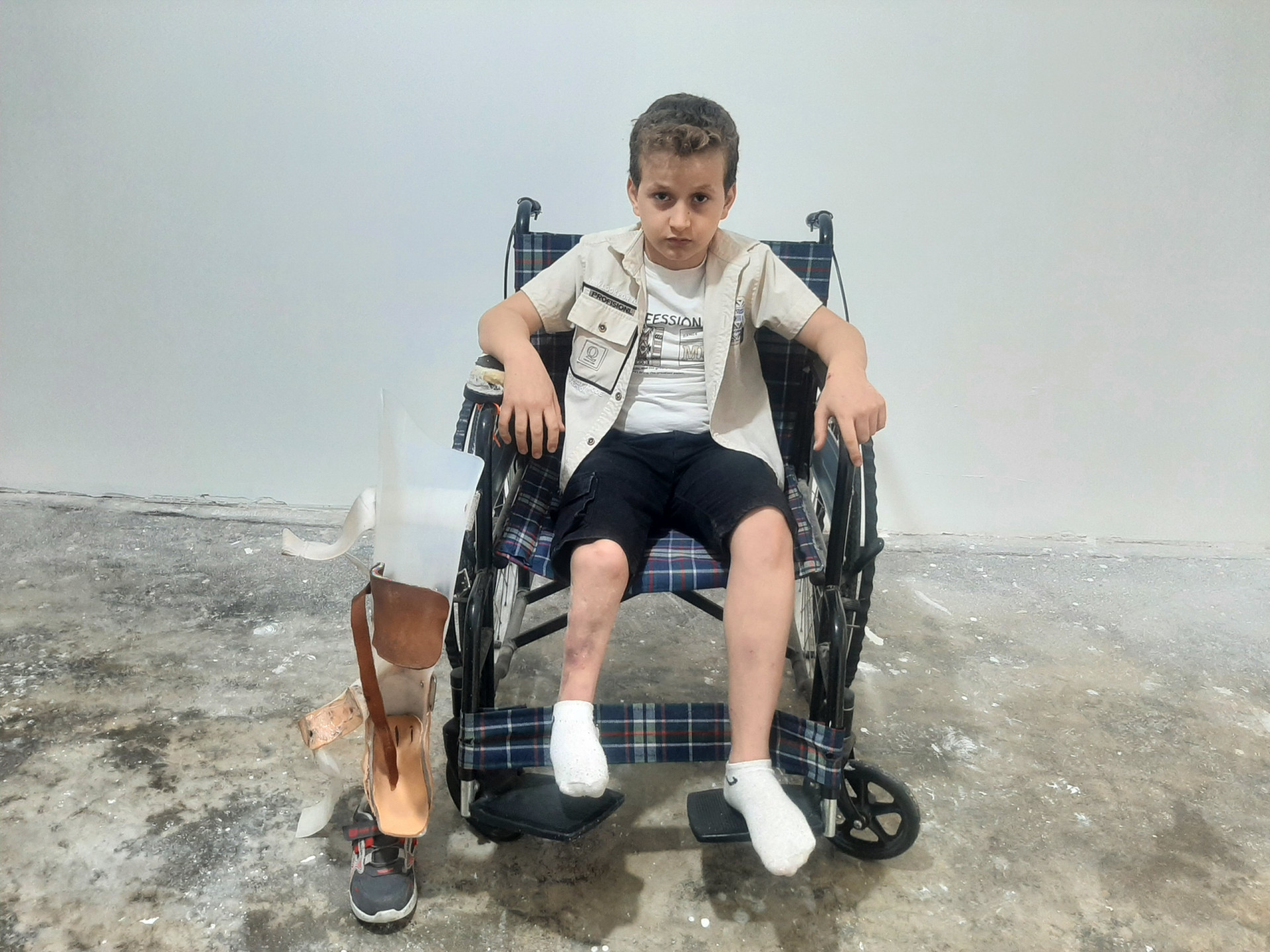 The Child Ahmed Urgently Needs a Surgical Operation