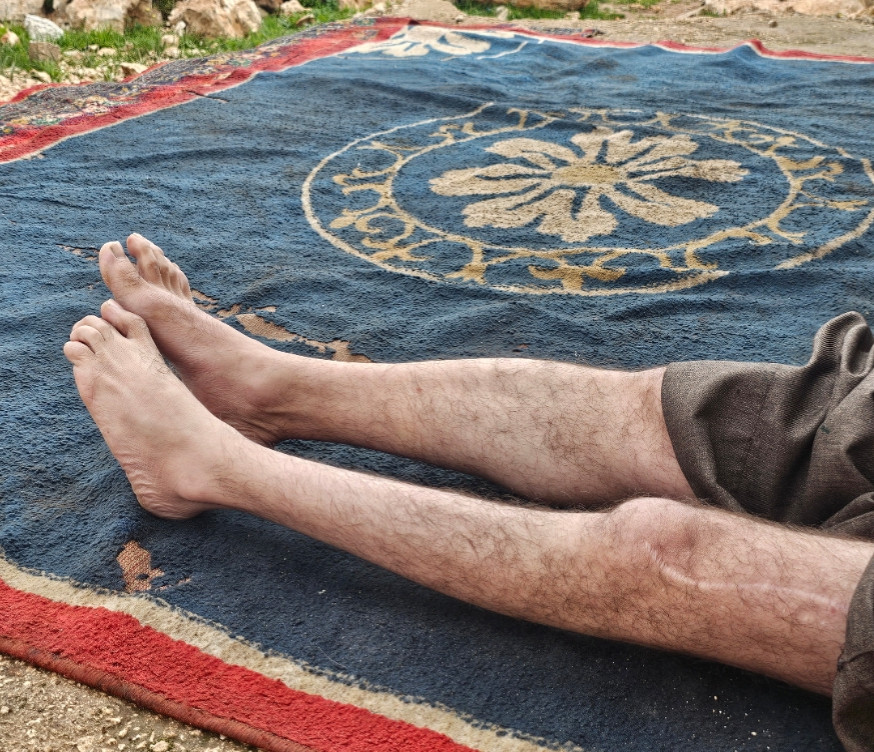 خطء طبي سبب له الشلل