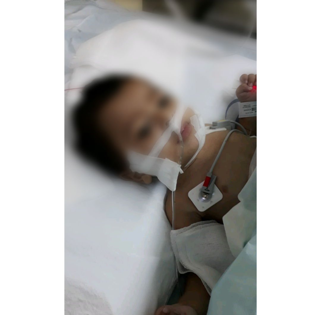 طفل يعاني من تبعات ارتفاع شديد في الحرارة