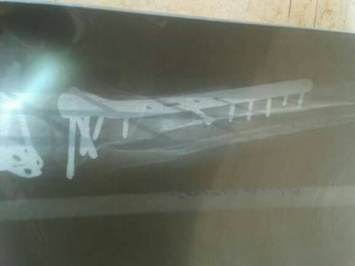 Man needing surgey