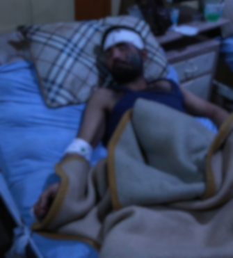 management costs after a head injury