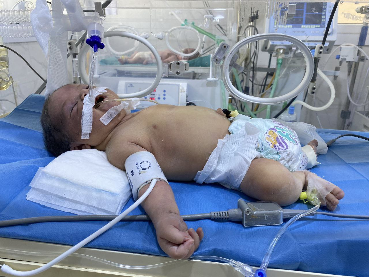 Nazem is a baby who needs your support and solidarity!