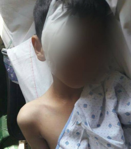 A child in need for treatment