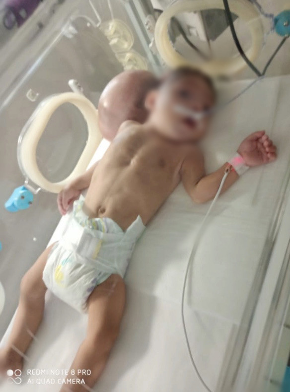 A little child with brain tumor needs urgent surgery