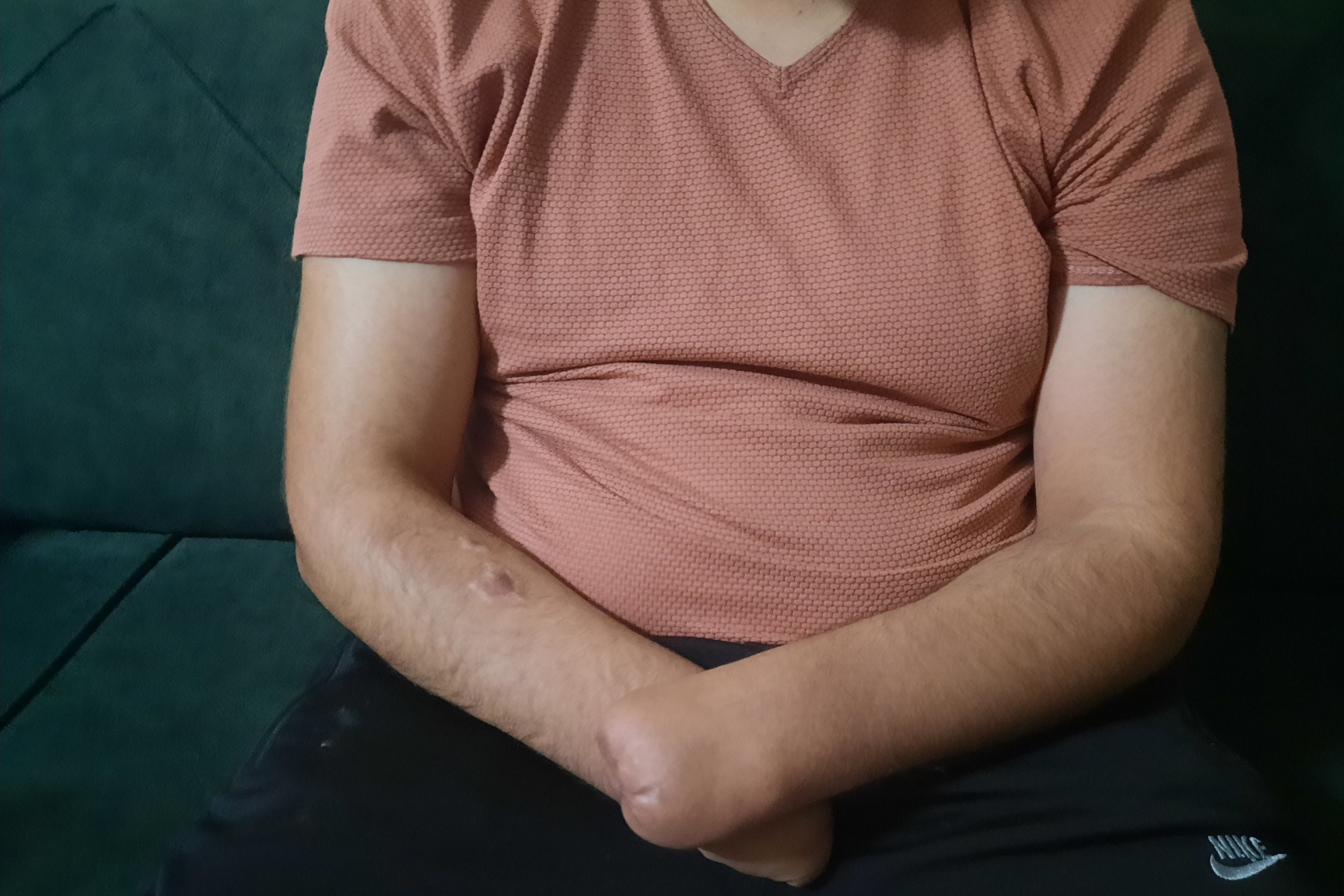 An explosive device changed Mosab's life.