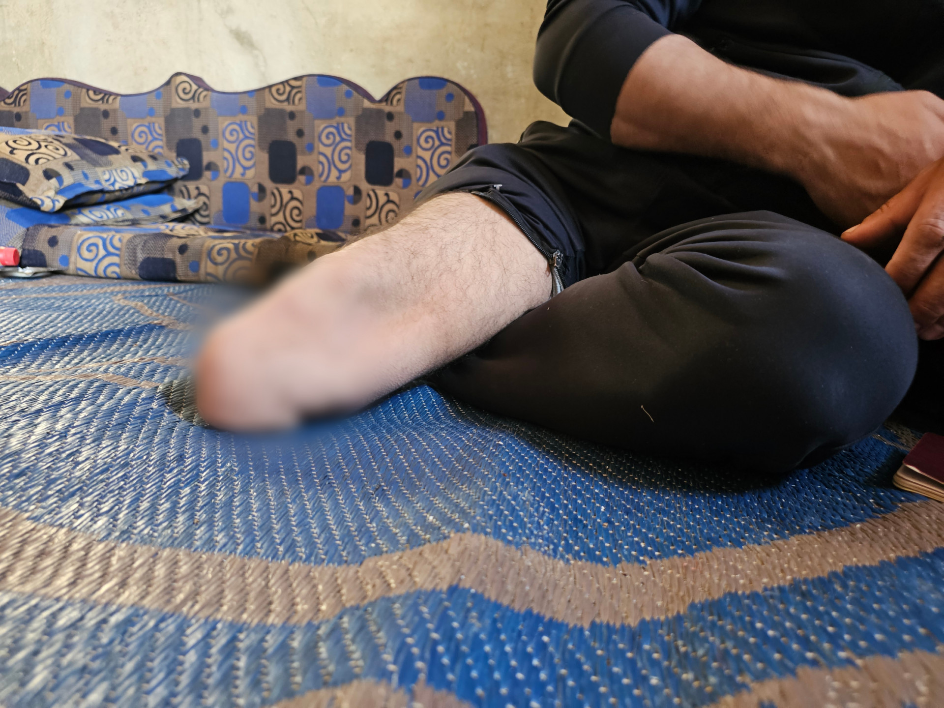 أب مبتور الساق يعيل أسرته في خيمة