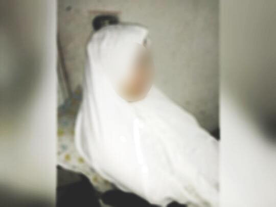 A Divorced Woman with Brain Hemorrhage