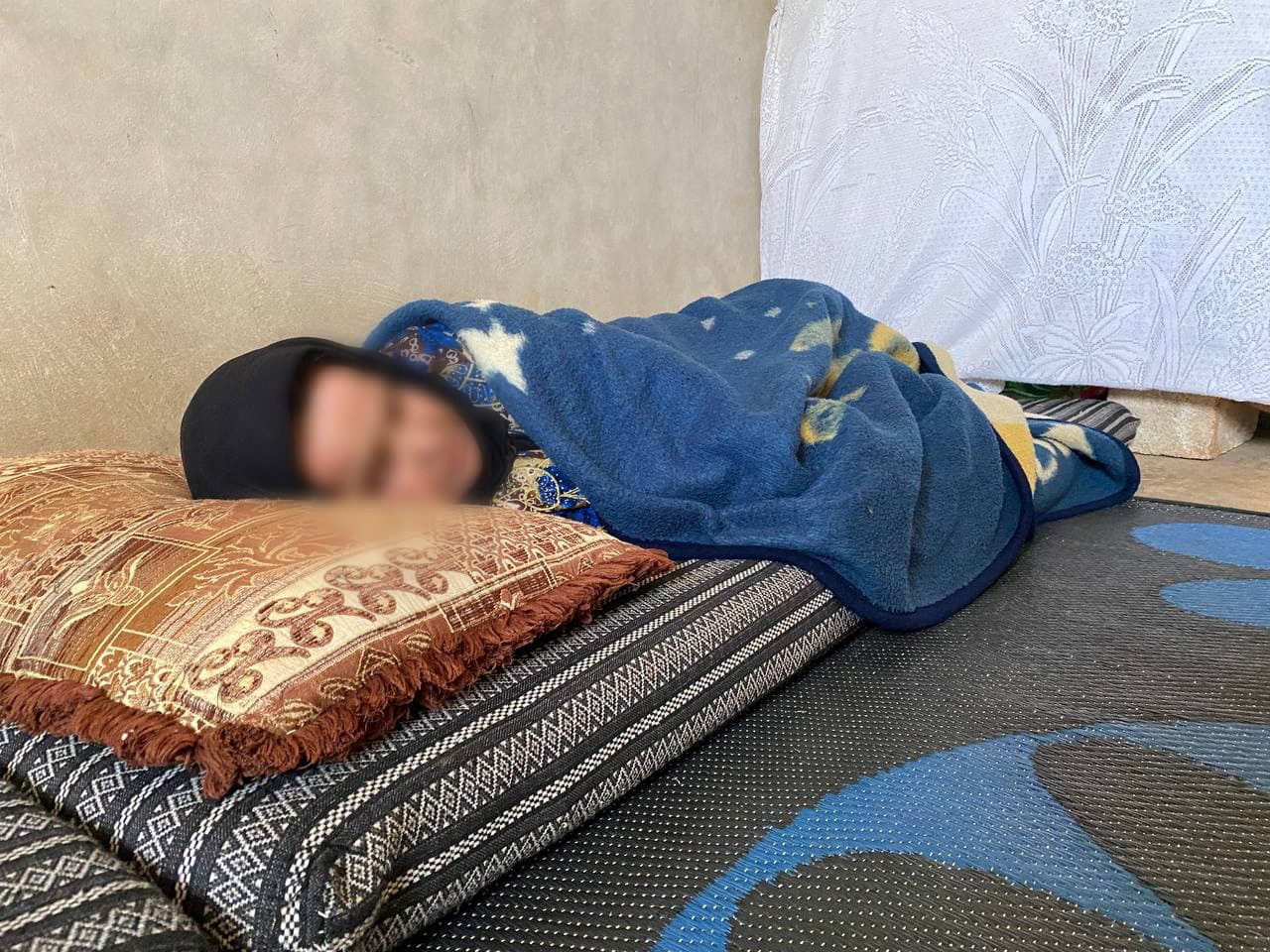 Shamsa is suffering from hydrocephalus and needs your urgent help