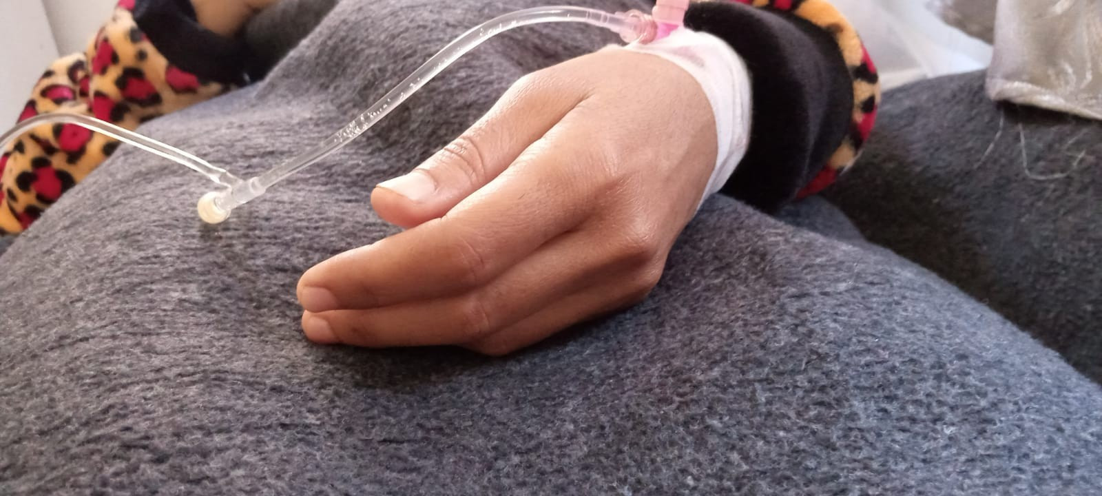 سيدة بحاجة عملية استئصال مرارة بأسرع وقت