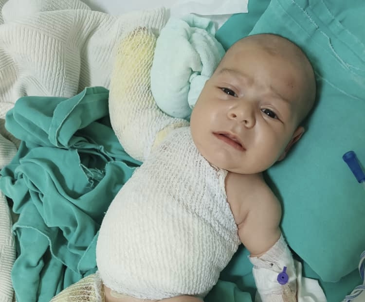 Third-Degree Burns, One Month of Life – Help Baby Adam