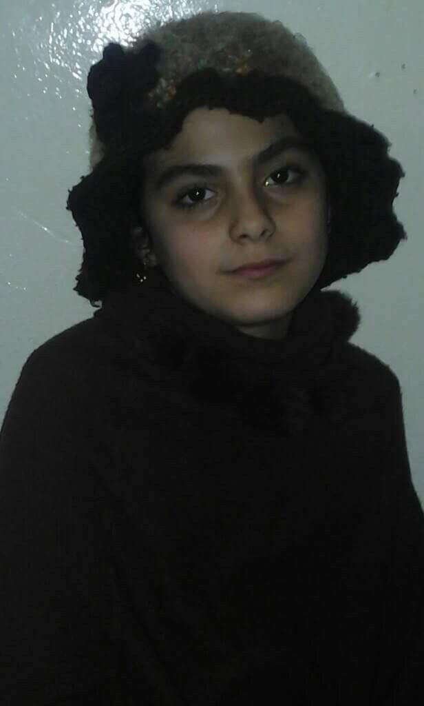 10 years old with maxillary problems