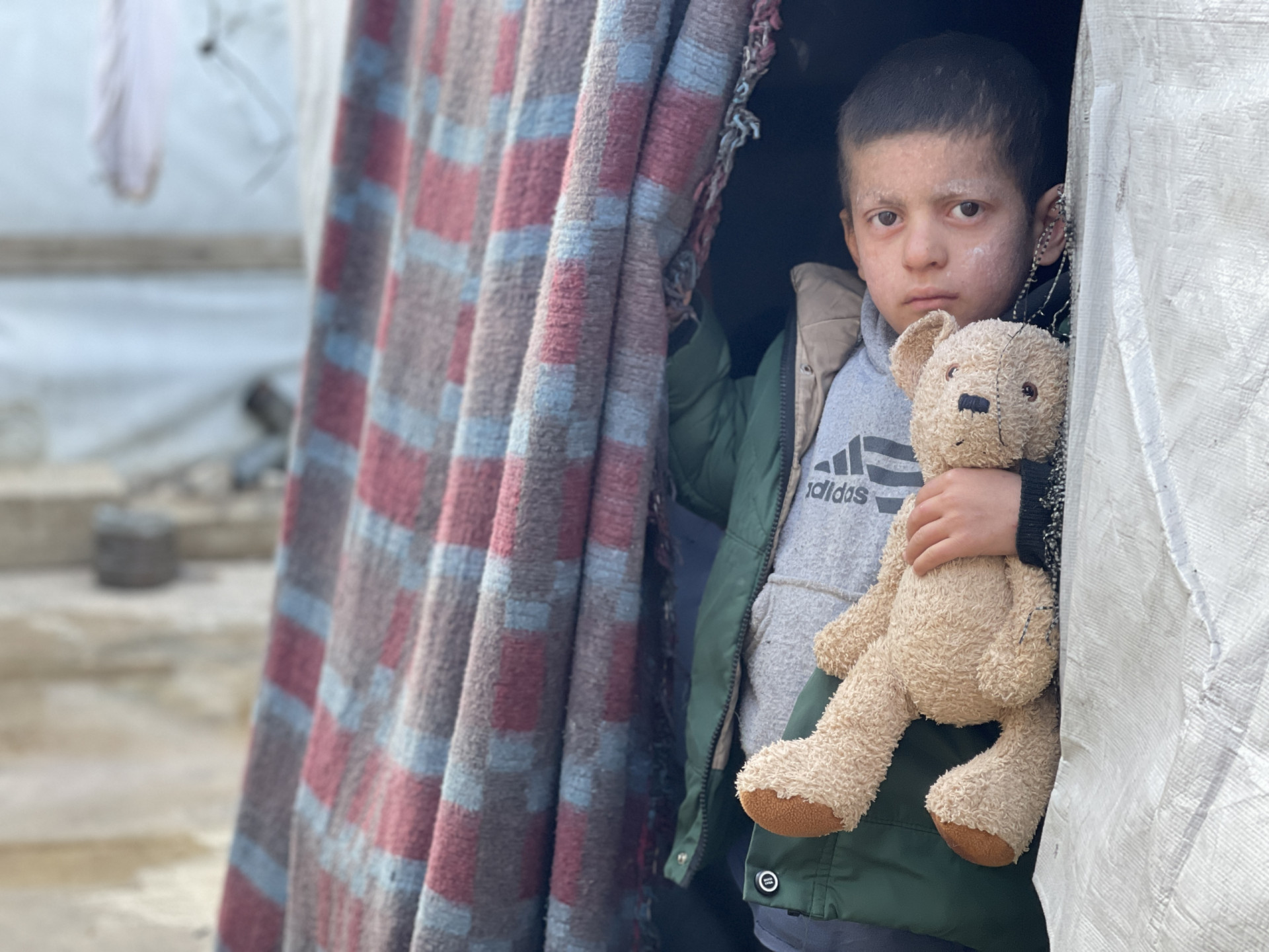 Severe pain afflicts the body of the child Na'im.