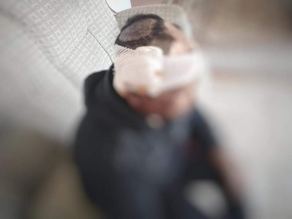 Ibrahim with dermatological disease needs a surgery