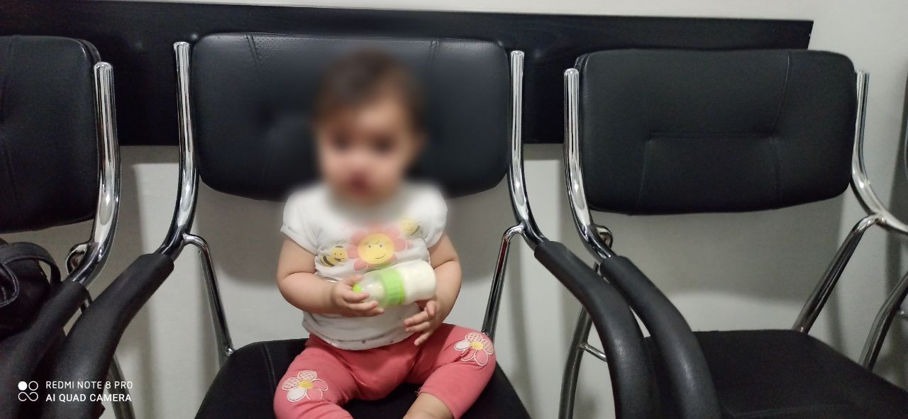 مريم تعاني من شفة أرنبية وبحاجة مساعدتكم للتخلص منها