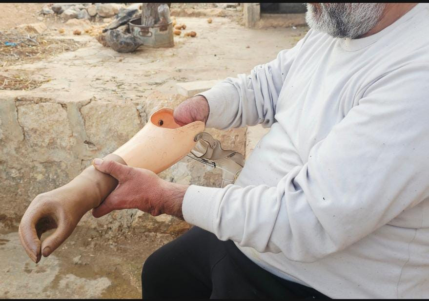 إصابة الحرب سرقت قوته