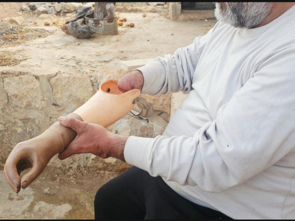 إصابة الحرب سرقت قوته