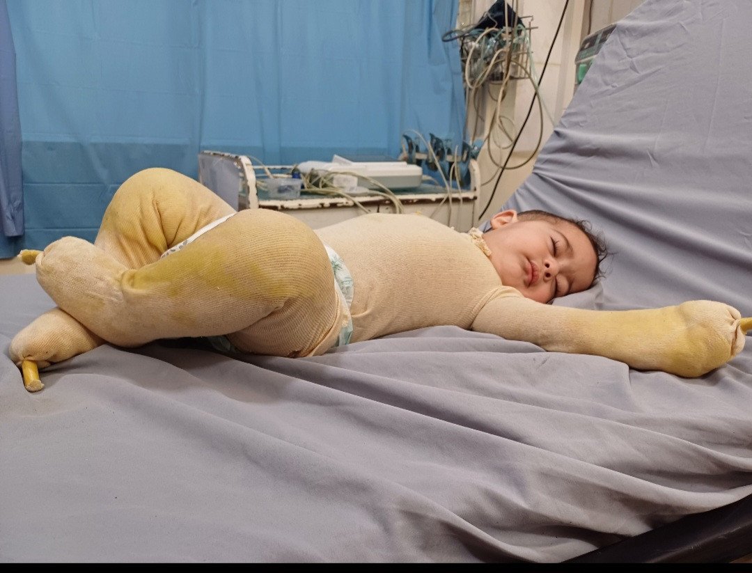 Nazir needs donations to get treatment