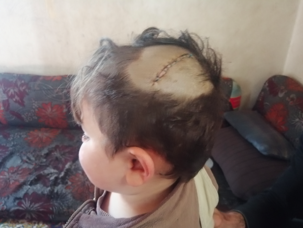 A child needs urgent surgery