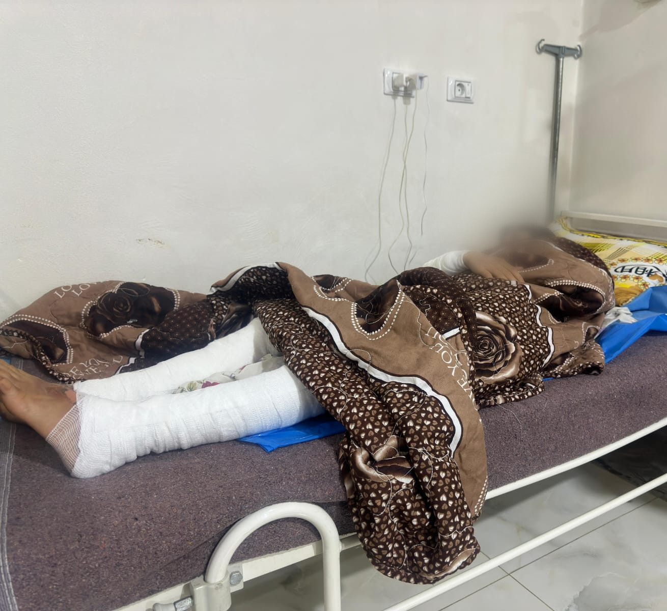 A fire in their tent almost killed Amani