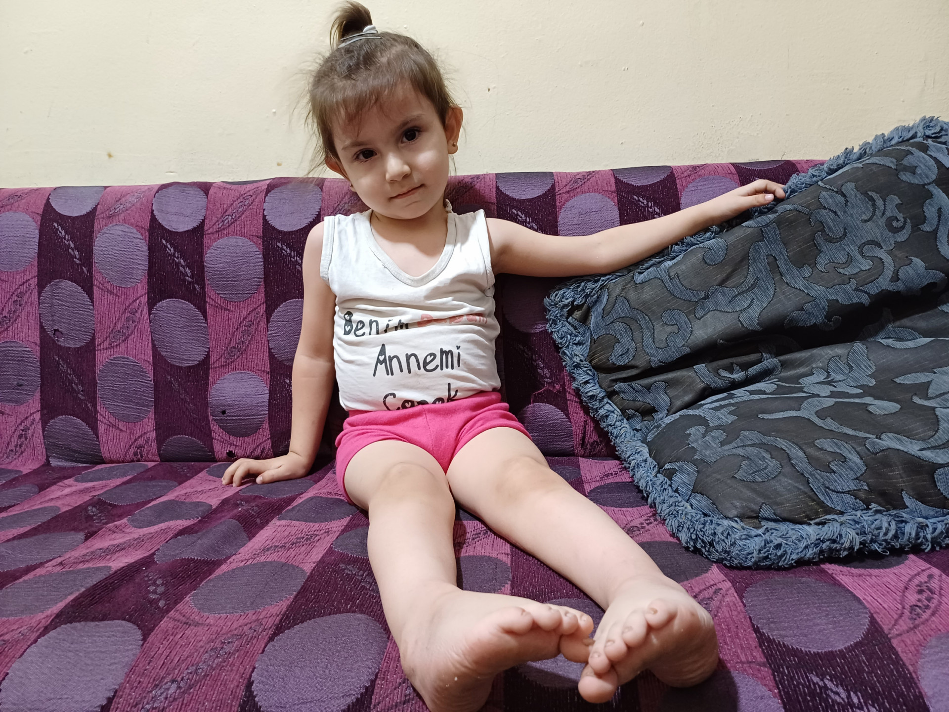 Mona suffers from foot deformities and needs your help!