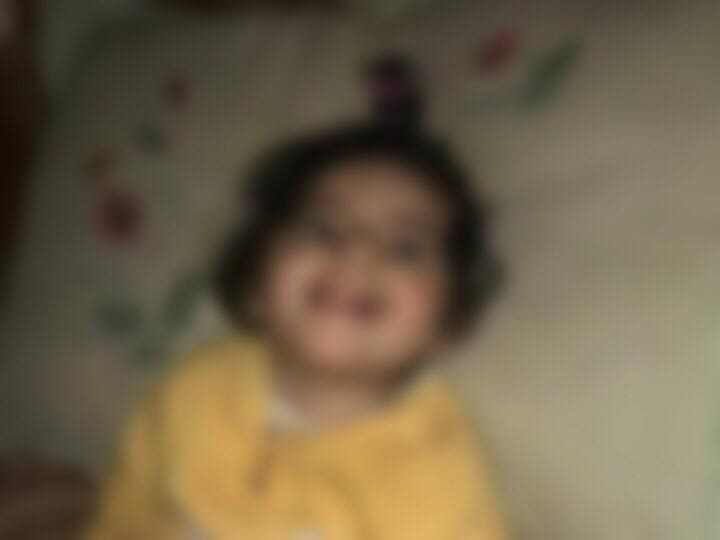 A little girl needs Physiotherapy