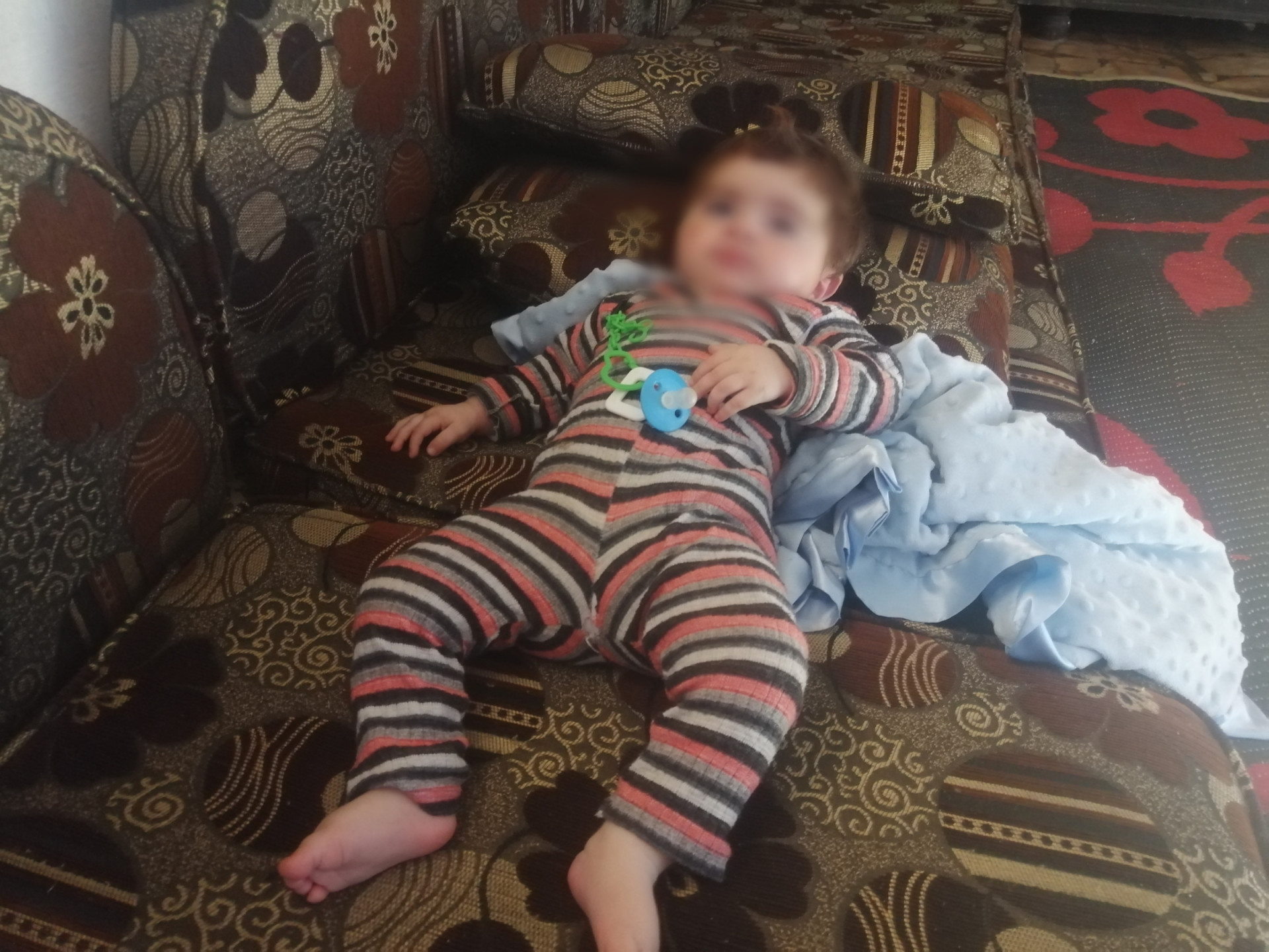 A child suffers from severe hearing loss and needs hearing aid