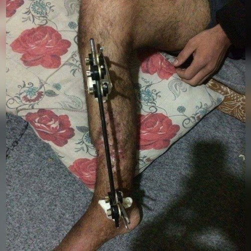 an injured man in need for treatment expenses