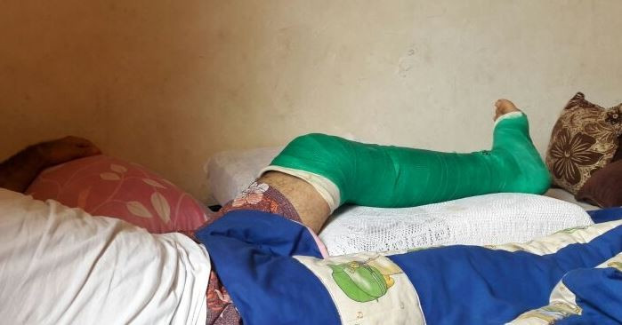 A young boy needs external fixation of his feet