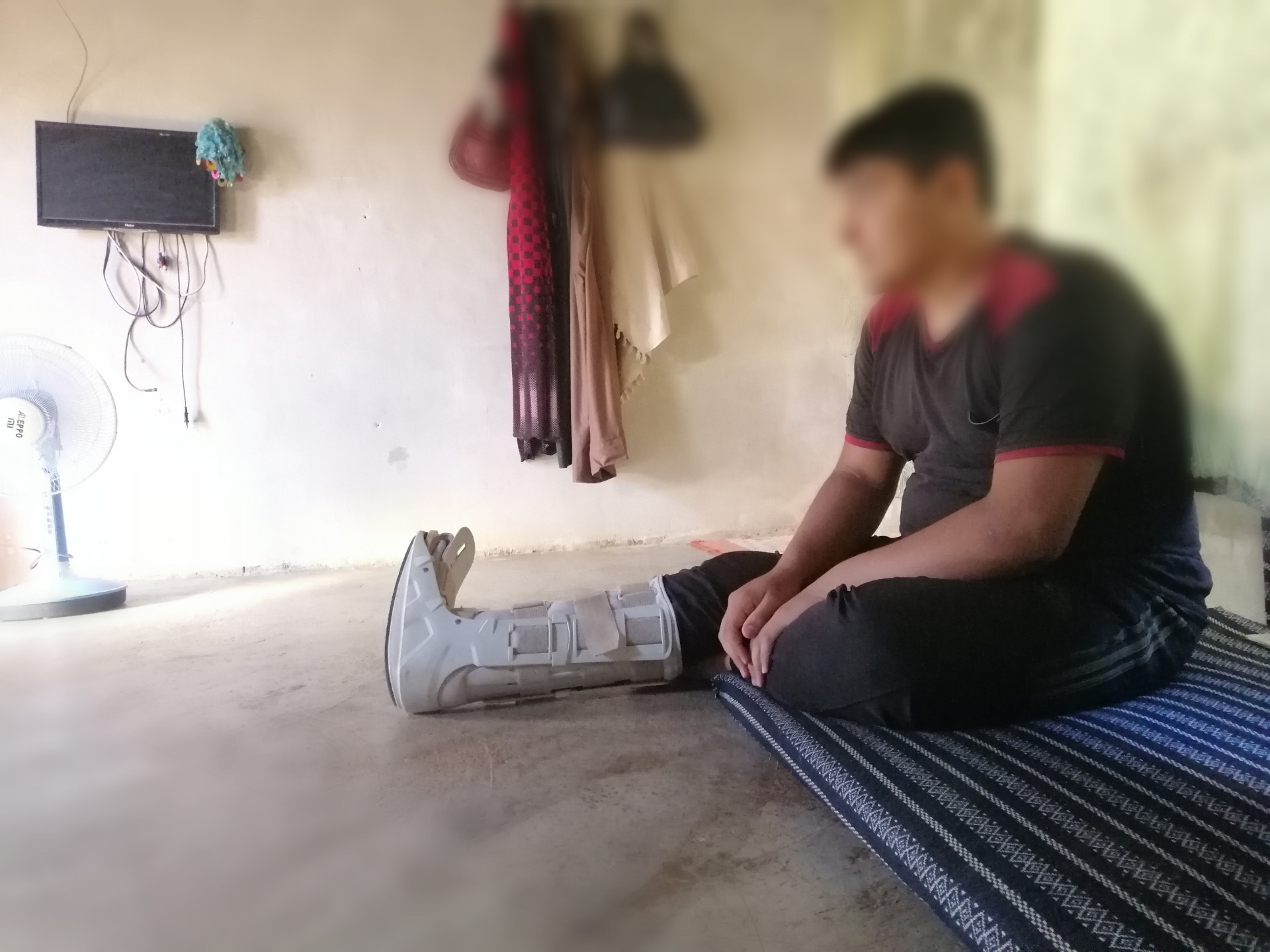 Muhammad got injured due to bombing which caused his foot to get amputated and needs a prosthetic limb.