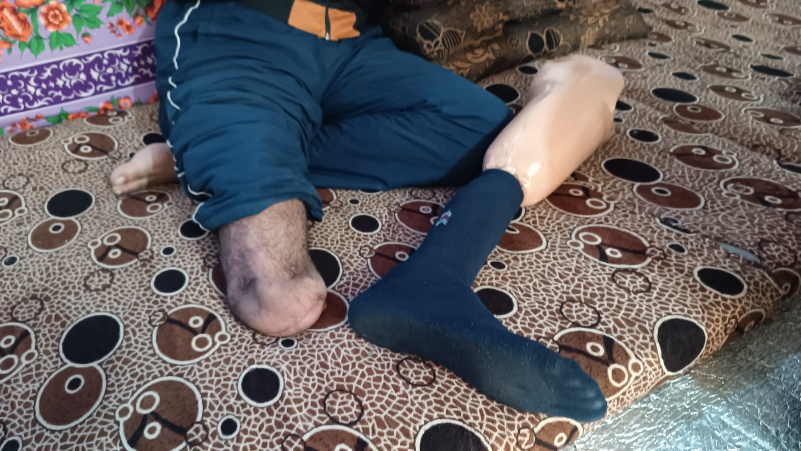 في خيمة بسيطة يملؤها العجز والمرض يقيم الأخ عبد الكريم