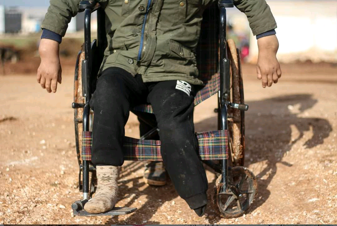A child needs a wheelchair