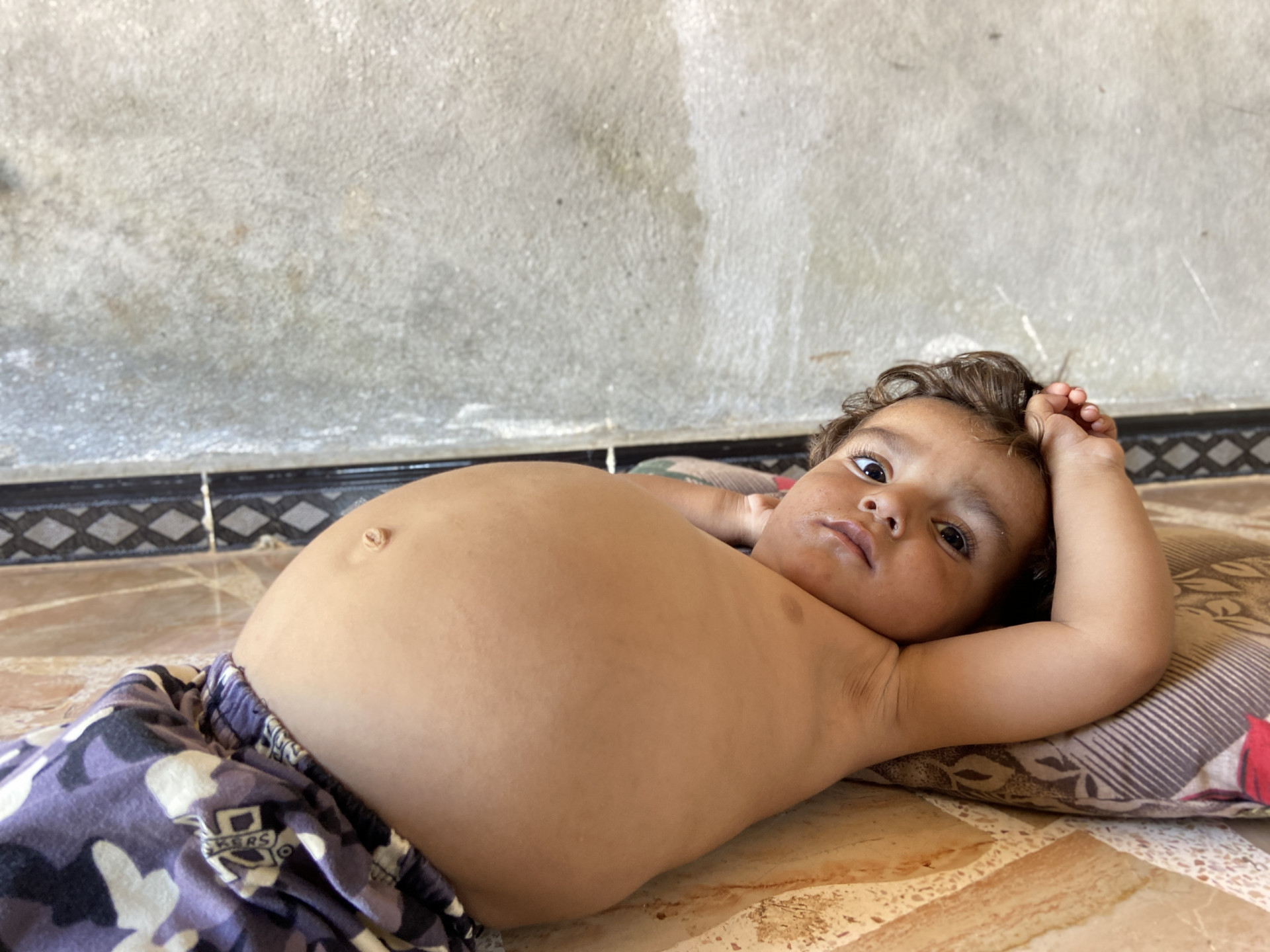 Due to poverty and need, this kid's health worsens day by day..