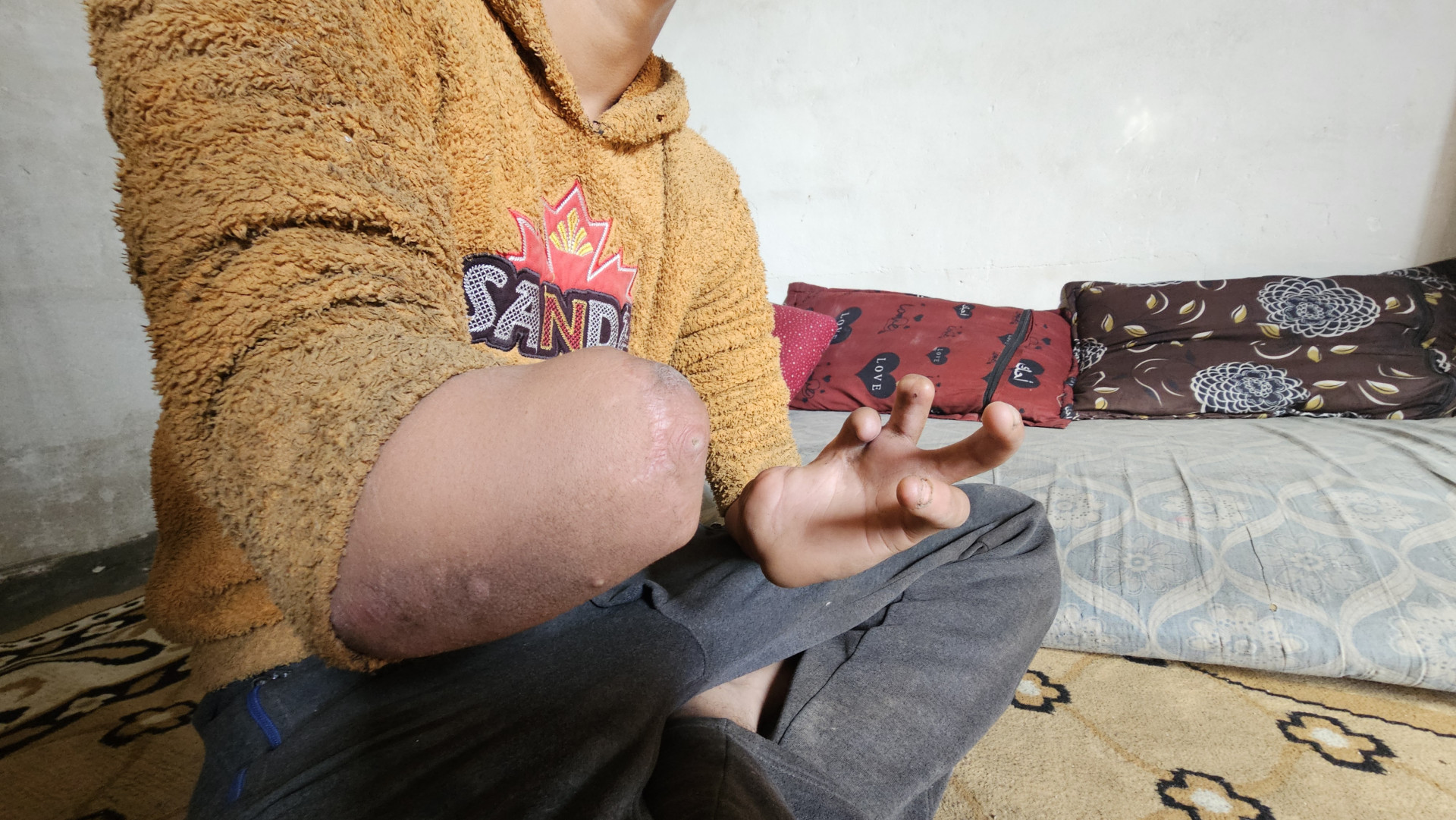 A tank shell hit Fatima and her family, seriously injuring them. They need your help.