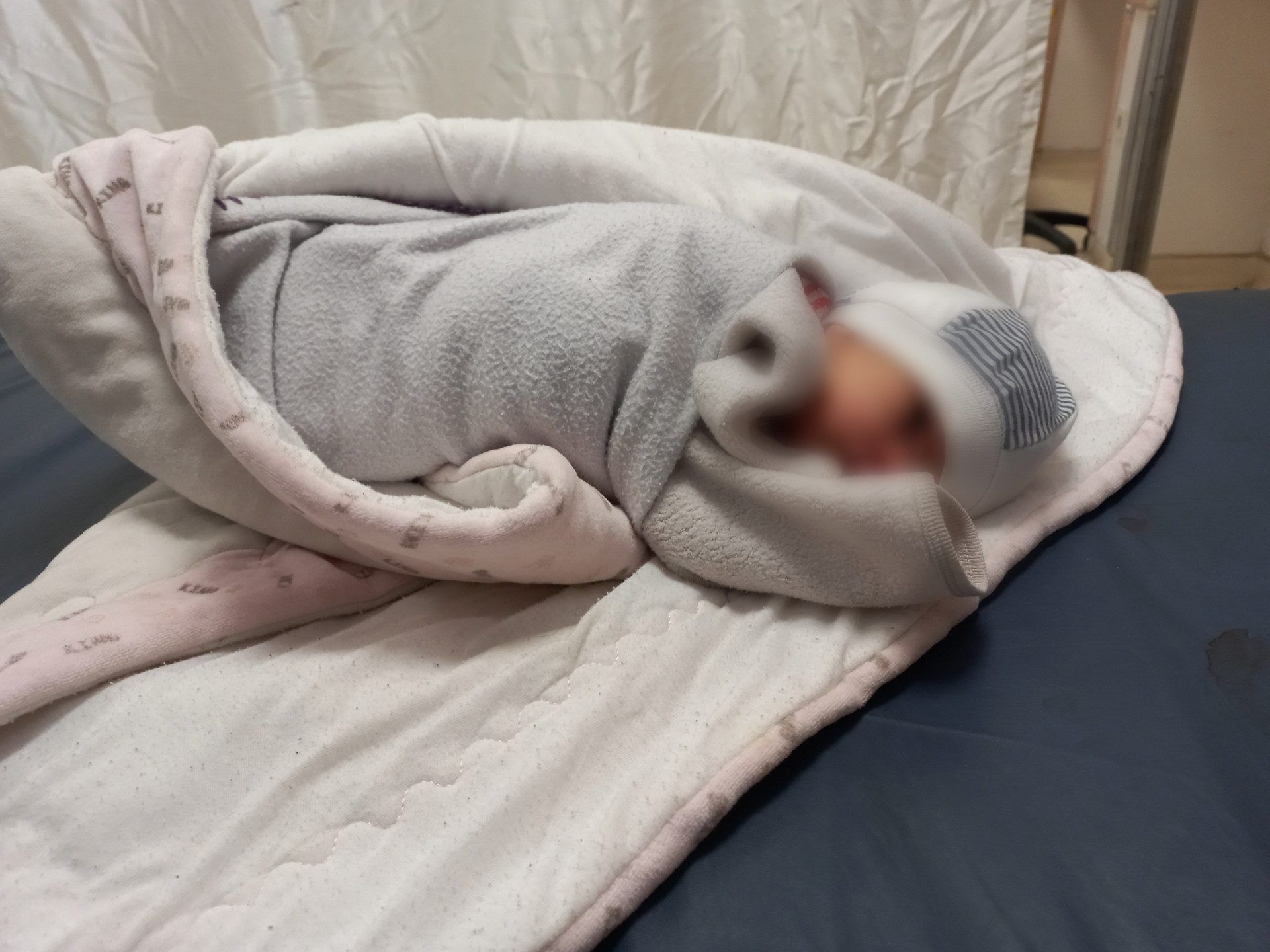 A little girl with great suffering
