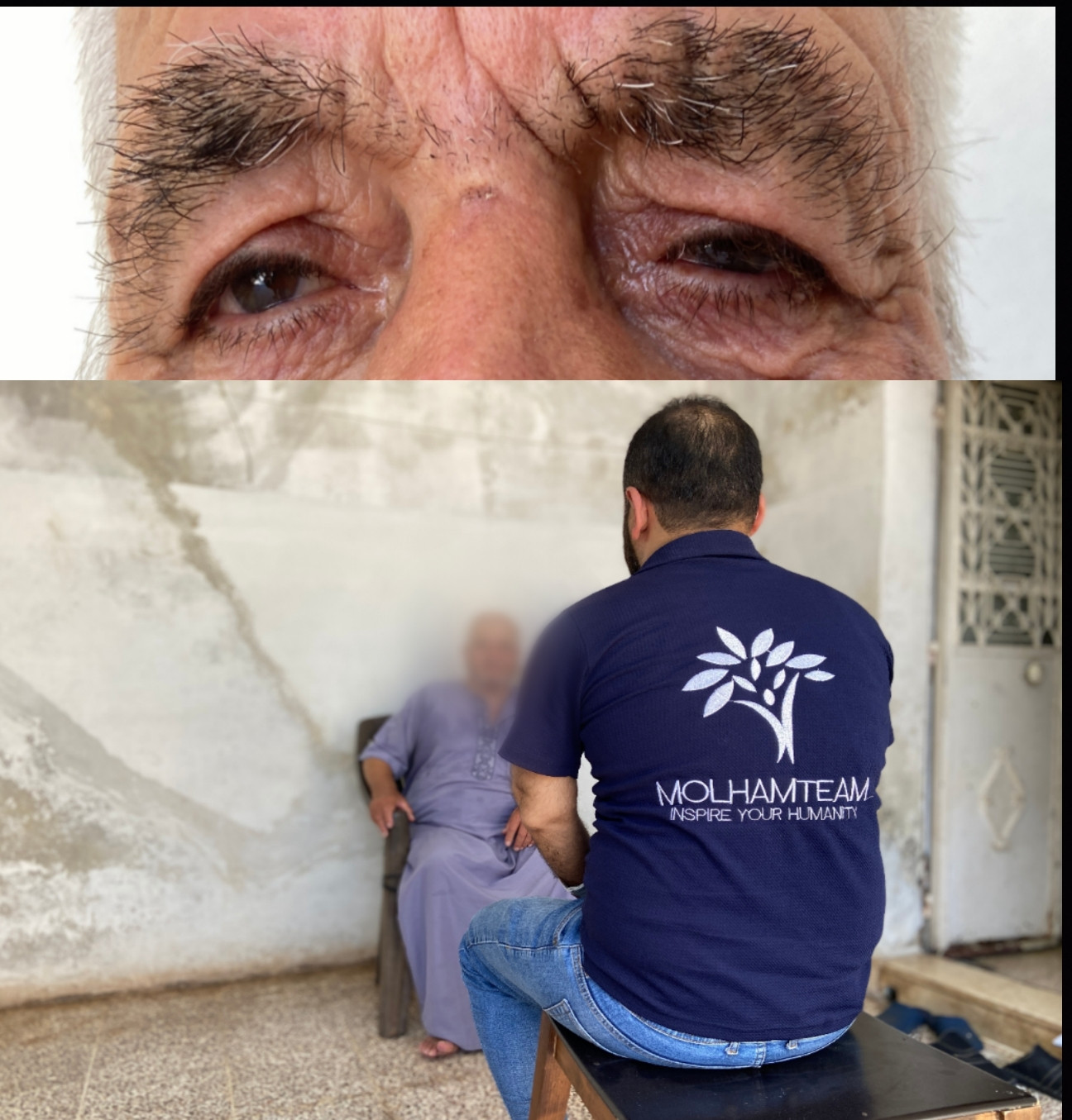 The surgery can stop the bleeding in his eye and prevent complete blindness!